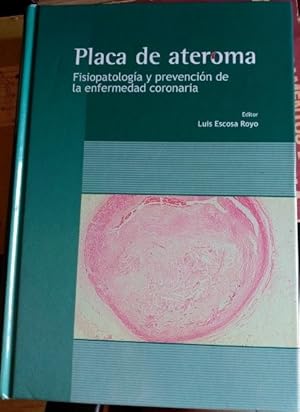 PLACA DE ATEROMA. FISIOPATOLOGIA Y PREVENCION DE LA ENFERMEDAD CORONARIA.