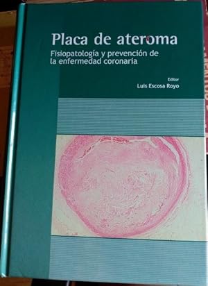 Imagen del vendedor de PLACA DE ATEROMA. FISIOPATOLOGIA Y PREVENCION DE LA ENFERMEDAD CORONARIA. a la venta por Libreria Lopez de Araujo