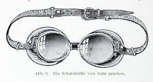 Eine neue Schutzbrille für Kraftfahrer (pp.136-138, 3 Abb.).