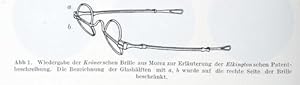 Image du vendeur pour Eine Zweistrkebrille Elkingtonscher Art (pp.154-157, 3 Abb.). & Eine neue aufgetauchte Form der Stirnbrille (pp.158-160, 3 Abb.). mis en vente par Antiq. F.-D. Shn - Medicusbooks.Com