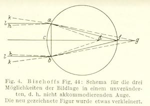 Image du vendeur pour Geschichtliches zur Erkenntnis der Hypermetrophie und zur Brillenkunde (pp.111-120, 4 Fig.). mis en vente par Antiq. F.-D. Shn - Medicusbooks.Com