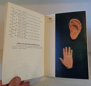 Model of Human Body Showing Acupuncture Points and Courses of Meridians; Hand Model Showing Acupu...
