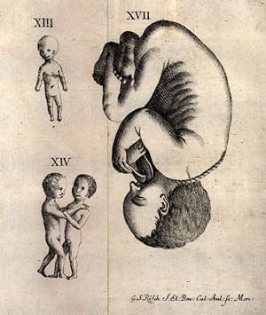 Embryologia sacra de officio sacerdotum medicorum, & aliorum circa aeternam parvulorum in utero e...