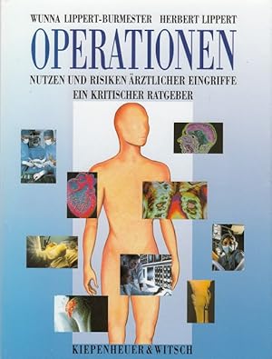 Imagen del vendedor de Operationen - Nutzen und Risiken rztlicher Eingriffe a la venta por Versandantiquariat Nussbaum