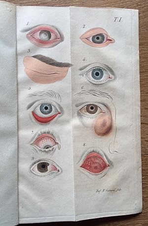 Die Krankheiten des menschlichen Auges.