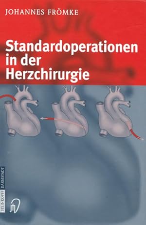 Immagine del venditore per Standardoperationen in der Herzchirurgie venduto da BuchWeltWeit Ludwig Meier e.K.