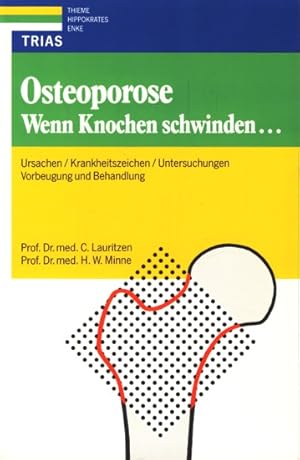 Seller image for Osteoporose - Wenn Knochen schwinden. : Ursachen, Krankheitszeichen, Untersuchungen, Vorbeugung und Behandlung ;. for sale by TF-Versandhandel - Preise inkl. MwSt.