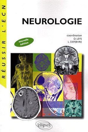 Neurologie