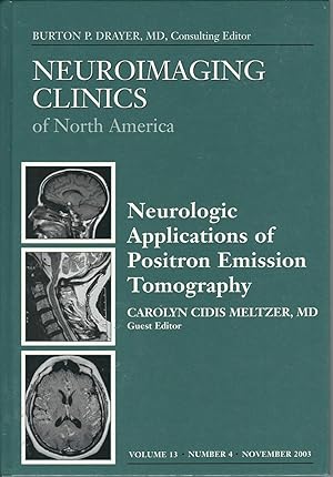 Neurologic Applications of Positron Emission Tomography (NEUROIMAGING CLINICS OF NORTH AMERICA, 1...