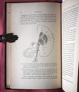 Bild des Verkufers fr Lectures on Diagnosis of Diseases of the Brain Delivered at University College Hospital. zum Verkauf von Patrick Pollak Rare Books ABA ILAB