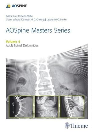 Seller image for Aospine Master Series, Vol. 4: Adult Spinal Deformities for sale by AHA-BUCH GmbH