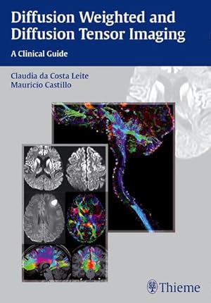 Bild des Verkufers fr Diffusion Weighted and Diffusion Tensor Imaging : A Clinical Guide zum Verkauf von AHA-BUCH GmbH