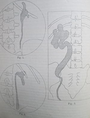Röntgenogramme von Harnblase und Nierenbecken (Pyelographie). IN: Zbl. Chir., 32/51, S. 1398-1399...
