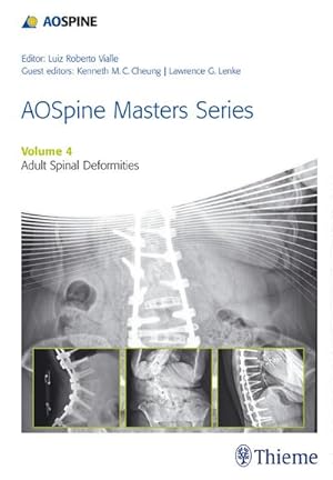 Seller image for Aospine Master Series, Vol. 4: Adult Spinal Deformities for sale by Rheinberg-Buch Andreas Meier eK