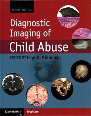 Imagen del vendedor de Diagnostic Imaging of Child Abuse a la venta por GreatBookPrices