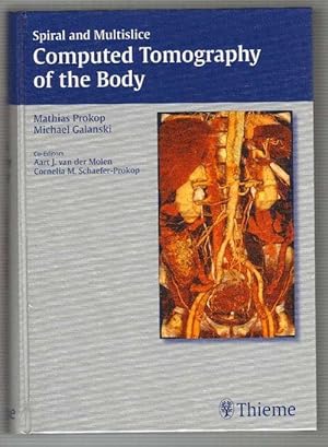 Spiral and multislice computed tomography of the body. 332 tables. Mit meist s/w Abbildungen und ...