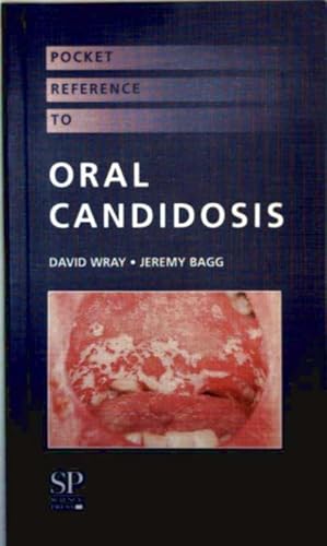 Pocket Referece to Oral Candidosis