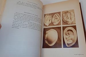 [Photographically Illustrated Books] "Haematoma Auris" IN The American Journal of Insanity Vol XXVII
