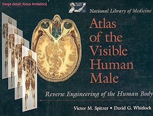 Atlas of the Visible Human Male; Reverse Engineering of the Human Body
