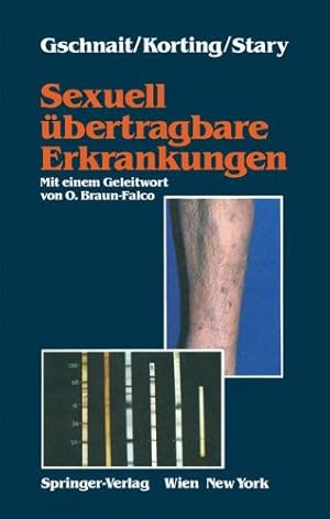 Bild des Verkufers fr Sexuell bertragbare Erkrankungen zum Verkauf von Allguer Online Antiquariat