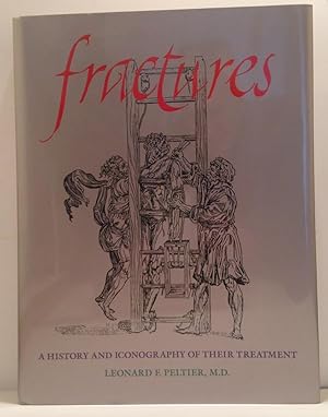 Fractures; A History and Iconography of Their Treatment