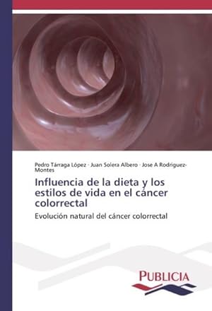 Seller image for Influencia de la dieta y los estilos de vida en el cncer colorrectal : Evolucin natural del cncer colorrectal for sale by AHA-BUCH GmbH