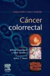 Cáncer colorrectal