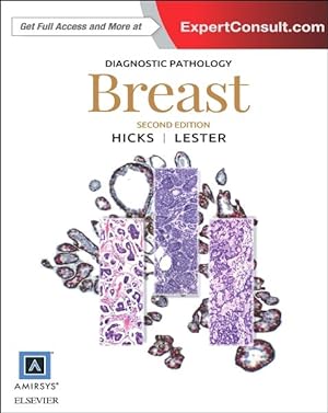 Seller image for Breast for sale by GreatBookPrices
