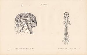 Brain, Gehirn, Nerven, Spinalnerv, Stahlstich um 1870 mit zwei Abbildungen des Gehirns, Blattgröß...