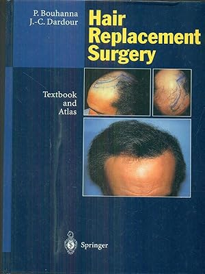 Seller image for Hair replacement Surgery for sale by Librodifaccia