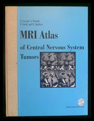 Bild des Verkufers fr MRI Atlas of Central Nervous System Tumors zum Verkauf von ANTIQUARIAT Franke BRUDDENBOOKS