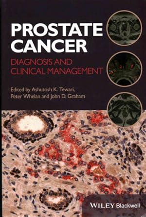 Image du vendeur pour Prostate Cancer : Diagnosis and Clinical Management mis en vente par GreatBookPrices