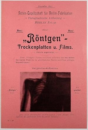 "Röntgen" - Trockenplatten u. Films.