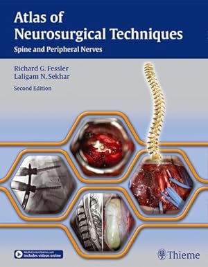 Image du vendeur pour Atlas of Neurosurgical Techniques - Spine and Peripheral Nerves mis en vente par BuchWeltWeit Ludwig Meier e.K.