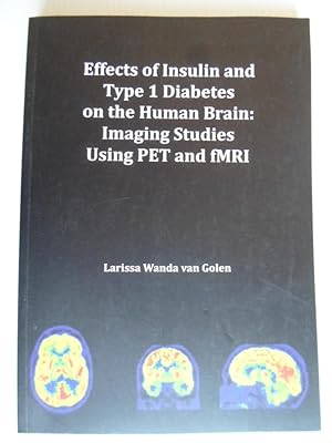 Effects of Insulin and Type 1 Diabetes on the Human Brain: Imaging Studies Using PET and fMRI