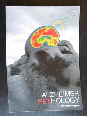 Alzheimer Pethology