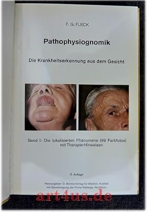 Pathophysiognomik : Die Krankheitserkennung aus dem Gesicht : Band 1: Die lokalisierenden Phänome...
