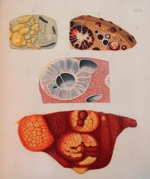 A clinical treatise on the diseases of the liver. Translated by Charles Murchison