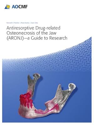 Bild des Verkufers fr Antiresorptive Drug-Related Osteonecrosis of the Jaw (ARONJ) - A Guide to Research zum Verkauf von AHA-BUCH GmbH