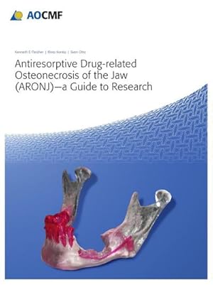 Bild des Verkufers fr Antiresorptive Drug-Related Osteonecrosis of the Jaw (ARONJ) - A Guide to Research zum Verkauf von BuchWeltWeit Ludwig Meier e.K.