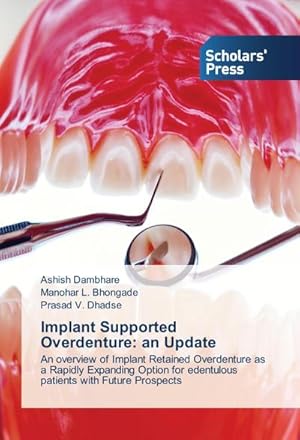 Seller image for Implant Supported Overdenture: an Update : An overview of Implant Retained Overdenture as a Rapidly Expanding Option for edentulous patients with Future Prospects for sale by AHA-BUCH GmbH