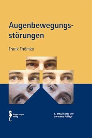 Seller image for Augenbewegungsstrungen for sale by AHA-BUCH GmbH