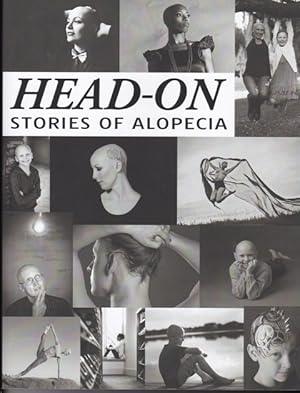 Head-On Stories of Alopecia