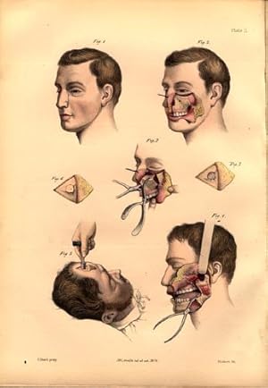 Bild des Verkufers fr A course of operative surgery. . . zum Verkauf von Jeremy Norman's historyofscience