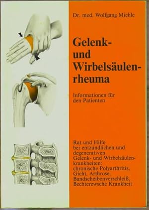 Bild des Verkufers fr Gelenk- und Wirbelsulenrheuma : Informationen fr den Patienten ; Rat und Hilfe bei entzndlichen und degenerativen Gelenk- und Wirbelsulenkrankheiten: chronische Polyarthritis, Gicht, Arthrose, Bandscheibenverschleiss, Bechterewsche Krankheit. Wolfgang Miehle. zum Verkauf von Ralf Bnschen