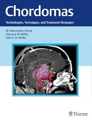 Seller image for Chordomas : Technologies, Techniques, and Treatment Strategies for sale by AHA-BUCH GmbH