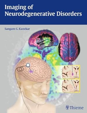 Bild des Verkufers fr Imaging of Neurodegenerative Disorders zum Verkauf von AHA-BUCH