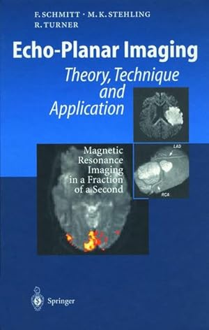 Seller image for Echo-Planar Imaging: Theory, Technique and Application for sale by Antiquariat Armebooks