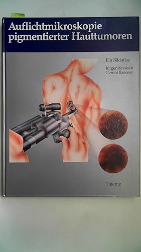 Seller image for Auflichtmikroskopie pigmentierter Hauttumoren for sale by Antiquariat Maiwald