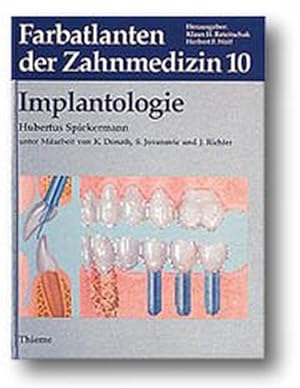 Seller image for Farbatlanten der Zahnmedizin, Bd.10, Implantologie for sale by Antiquariat Armebooks